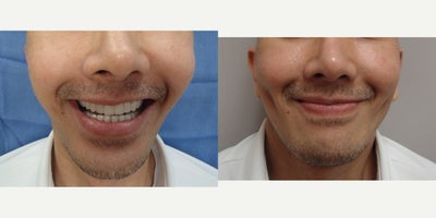 before and after image