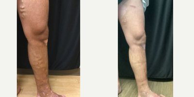 before and after image
