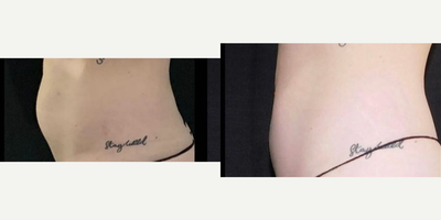 before and after image