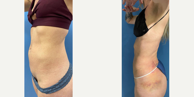 before and after image