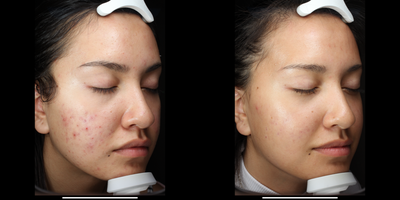 before and after image