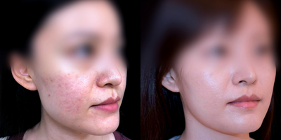 before and after image