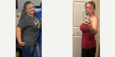 before and after image
