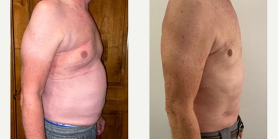 Evolve before and after photo