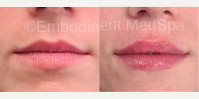 before and after image