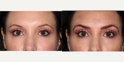 Microblading before and after photo