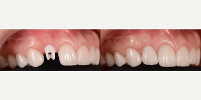 before and after image
