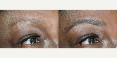 Permanent Makeup before and after photo