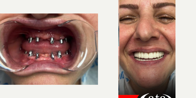before and after image