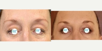 before and after image