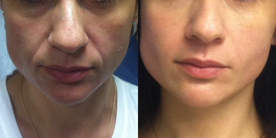 before and after image