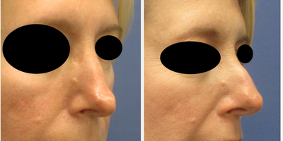 before and after image