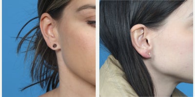 before and after image
