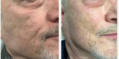 before and after image