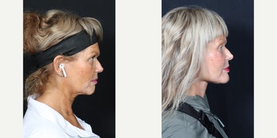 before and after image