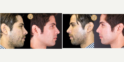 before and after image