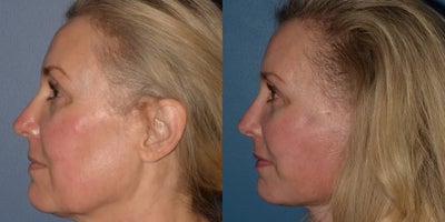 before and after image