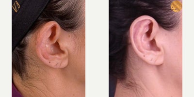 before and after image