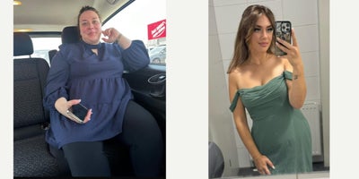 before and after image