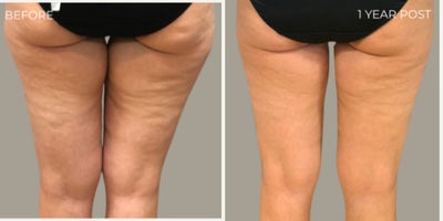 before and after image