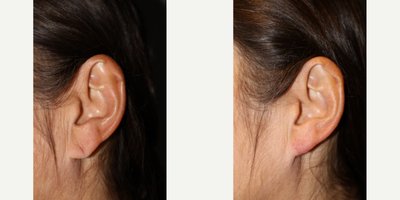 before and after image