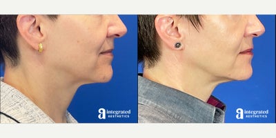 before and after image