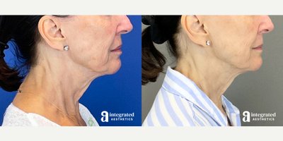 before and after image