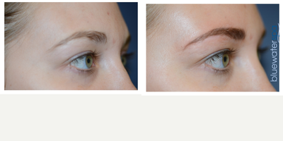 before and after image