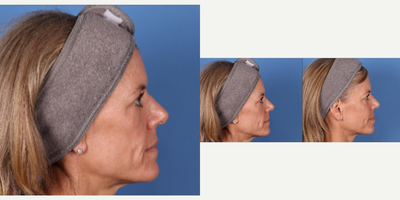 before and after image