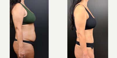 before and after image