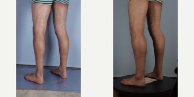 before and after image