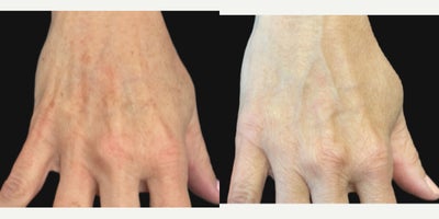 before and after image