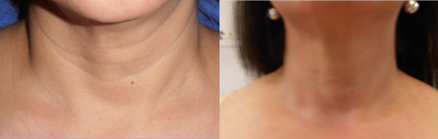 before and after image