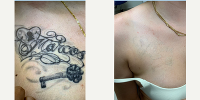 before and after image
