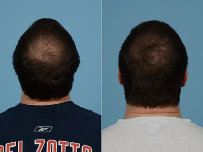 before and after image