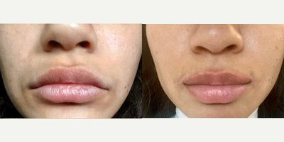 before and after image