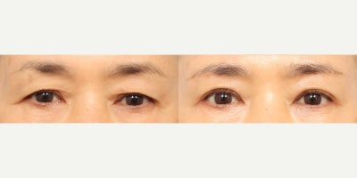 before and after image