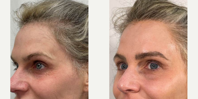 before and after image