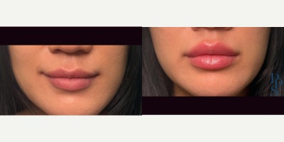 before and after image