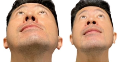 before and after image