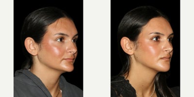 before and after image