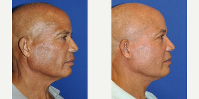 before and after image