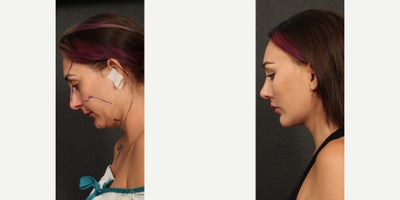 before and after image