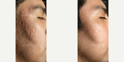 before and after image