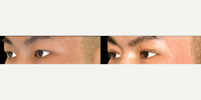 before and after image