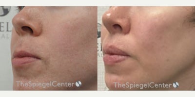 before and after image