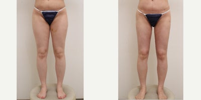 before and after image