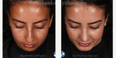 before and after image