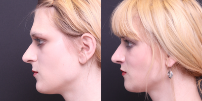 before and after image