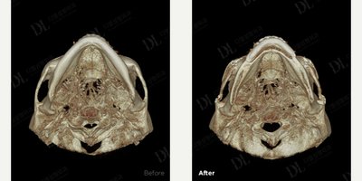 before and after image